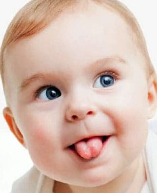 tongue-tie